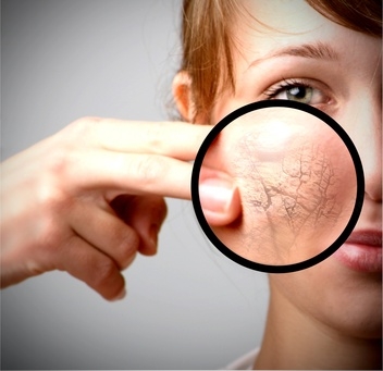 THALGODERMYL ANTI-ACNE TREATMENT